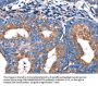 Rabbit anti-human MERTK polyclonal antibody
