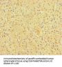 SP6 Antibody