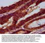 LARP7 Antibody