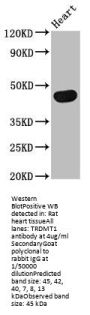 TRDMT1 Antibody