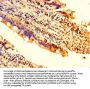 TRDMT1 Antibody