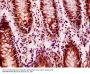 FILIP1L Antibody