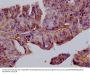 FILIP1L Antibody