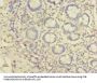 EIPR1 Antibody
