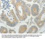 TP53BP2 Antibody