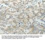TP53BP2 Antibody