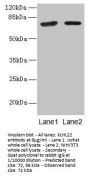 KLHL22 Antibody