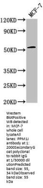 PPM1J Antibody