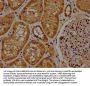 PPM1J Antibody