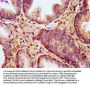 KCNT1 Antibody