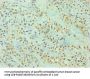 Rabbit anti-human Quinone oxidoreductase PIG3 polyclonal Antibody(TP53I3)