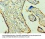 Rabbit anti-human Quinone oxidoreductase PIG3 polyclonal Antibody(TP53I3)