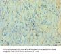 Rabbit anti-human Quinone oxidoreductase PIG3 polyclonal Antibody(TP53I3)