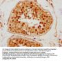 TAF7L Antibody