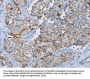 MUC1 Antibody