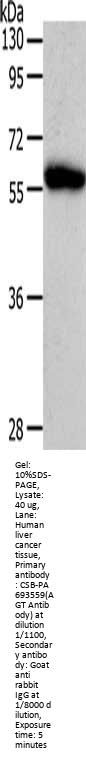 AGT Antibody