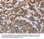 FAF1 Antibody