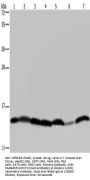Rabbit anti-human HIST1H2AH polyclonal antibody