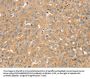 SNX2 Antibody