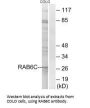 RAB6C Antibody