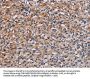 Rabbit anti-human PLCB3 polyclonal antibody