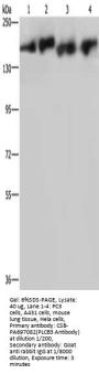 Rabbit anti-human PLCB3 polyclonal antibody