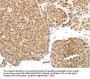 PSMD7 Antibody