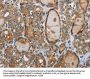 GGT1 Antibody