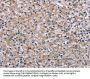 PLCL1 Antibody