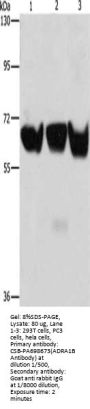 ADRA1B Antibody