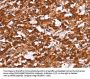 ARPC4 Antibody