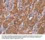 ARPC4 Antibody