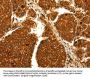 MAP1LC3A Antibody