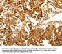 MAP1LC3A Antibody