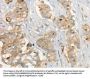 MMP9 Antibody