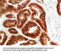 DNAJB1 Antibody