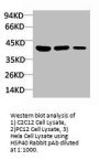 DNAJB1 Antibody