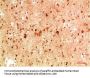 DNAJB1 Antibody