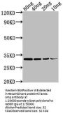 omp Antibody