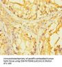 PAGE2B Antibody