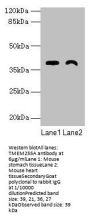 TMEM255A Antibody