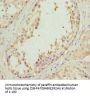 EFHC1 Antibody