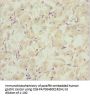 EFHC1 Antibody