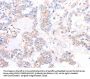Rabbit anti-human ADAP1 polyclonal antibody