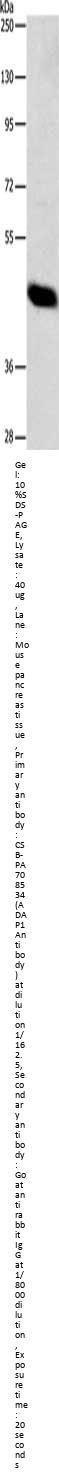 Rabbit anti-human ADAP1 polyclonal antibody