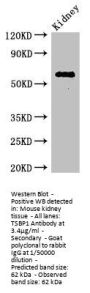 TSBP1 Antibody