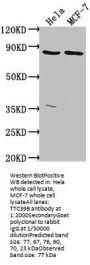 TTC39B Antibody