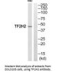 GTF2H2 Antibody