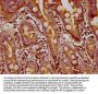 FMN1 Antibody