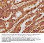 LEMD1 Antibody